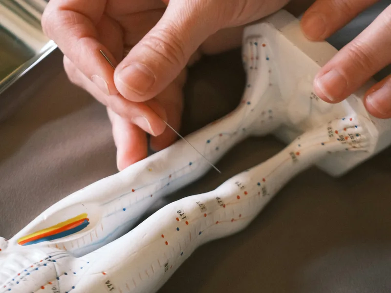 Acupuncture at Tahoe Chiropractic Clinic in South Lake Tahoe