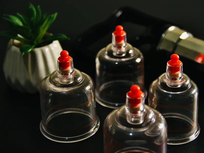 How Cupping Therapy works at Tahoe Chiropractic Clinic