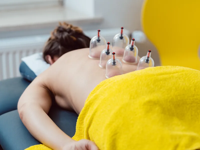 Cupping Therapy at Tahoe Chiropractic Clinic in South Lake Tahoe