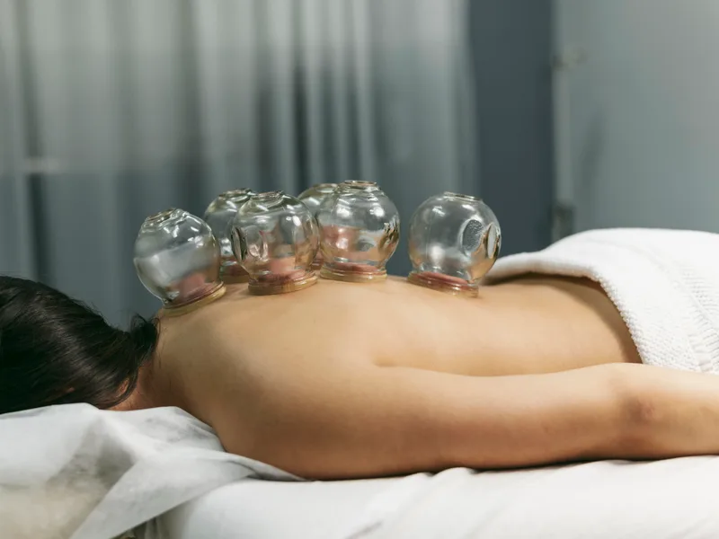 Cupping Therapy at Tahoe Chiropractic Clinic in South Lake Tahoe