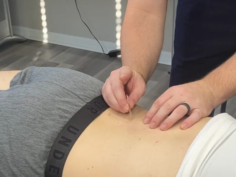 How Dry Needling works at Tahoe Chiropractic Clinic