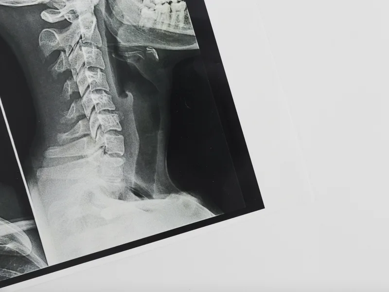 X-Rays at Tahoe Chiropractic Clinic in South Lake Tahoe